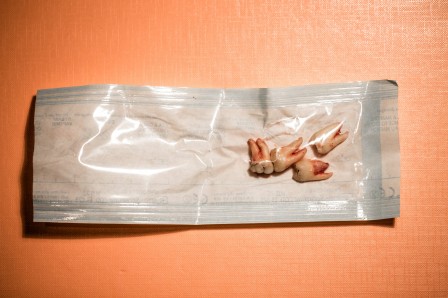 Sophie_Kirchner_sachet_sterilisation_dent.jpg